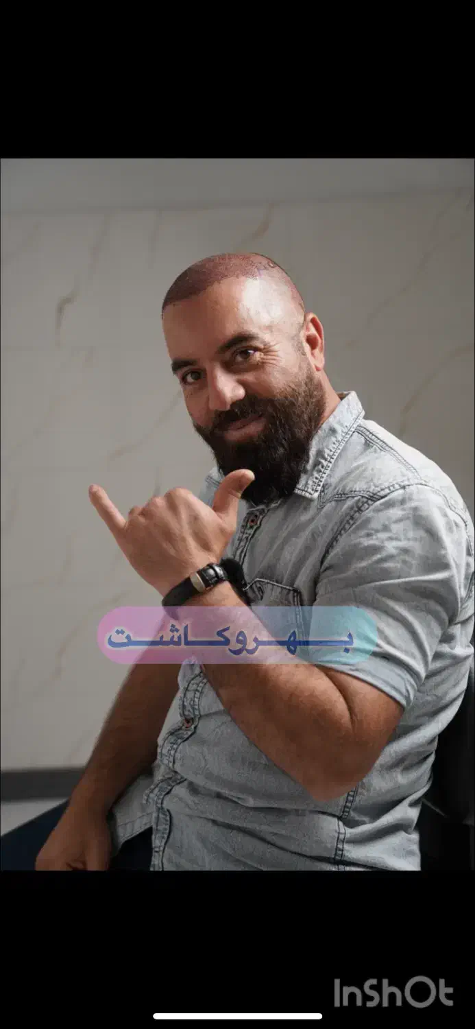 آموزش کاشت مو|خدمات آموزشی|قم, صفائیه|دیوار