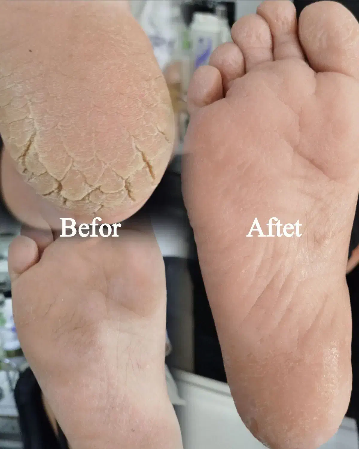 پدیکور و کف سابی پا|خدمات آرایشگری و زیبایی|شهرکرد, |دیوار