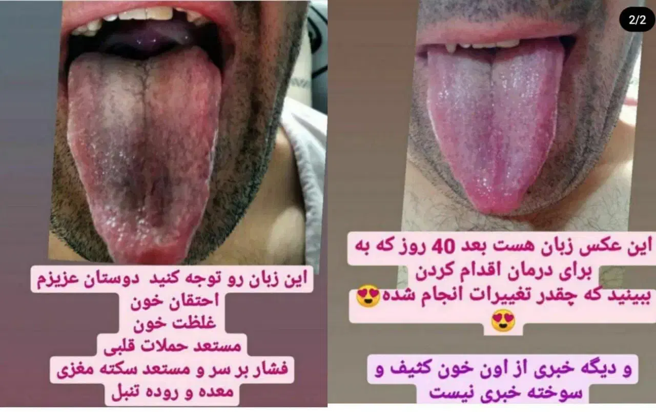 تشخیص بیماریها از روی زبان و درمان|خدمات آرایشگری و زیبایی|جیرفت, |دیوار