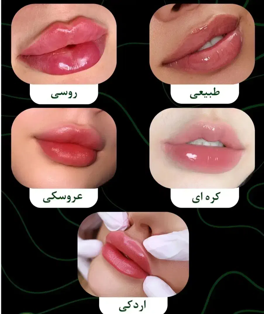 تزریق جوانسازها و ژل لب و گونه|خدمات آرایشگری و زیبایی|ورامین, ورامین|دیوار