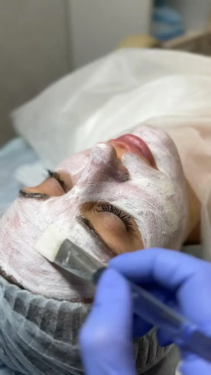 انجام خدمات پوستی فقط وفقط۳۰۰ به مدت محدود|خدمات آرایشگری و زیبایی|آهوران, |دیوار