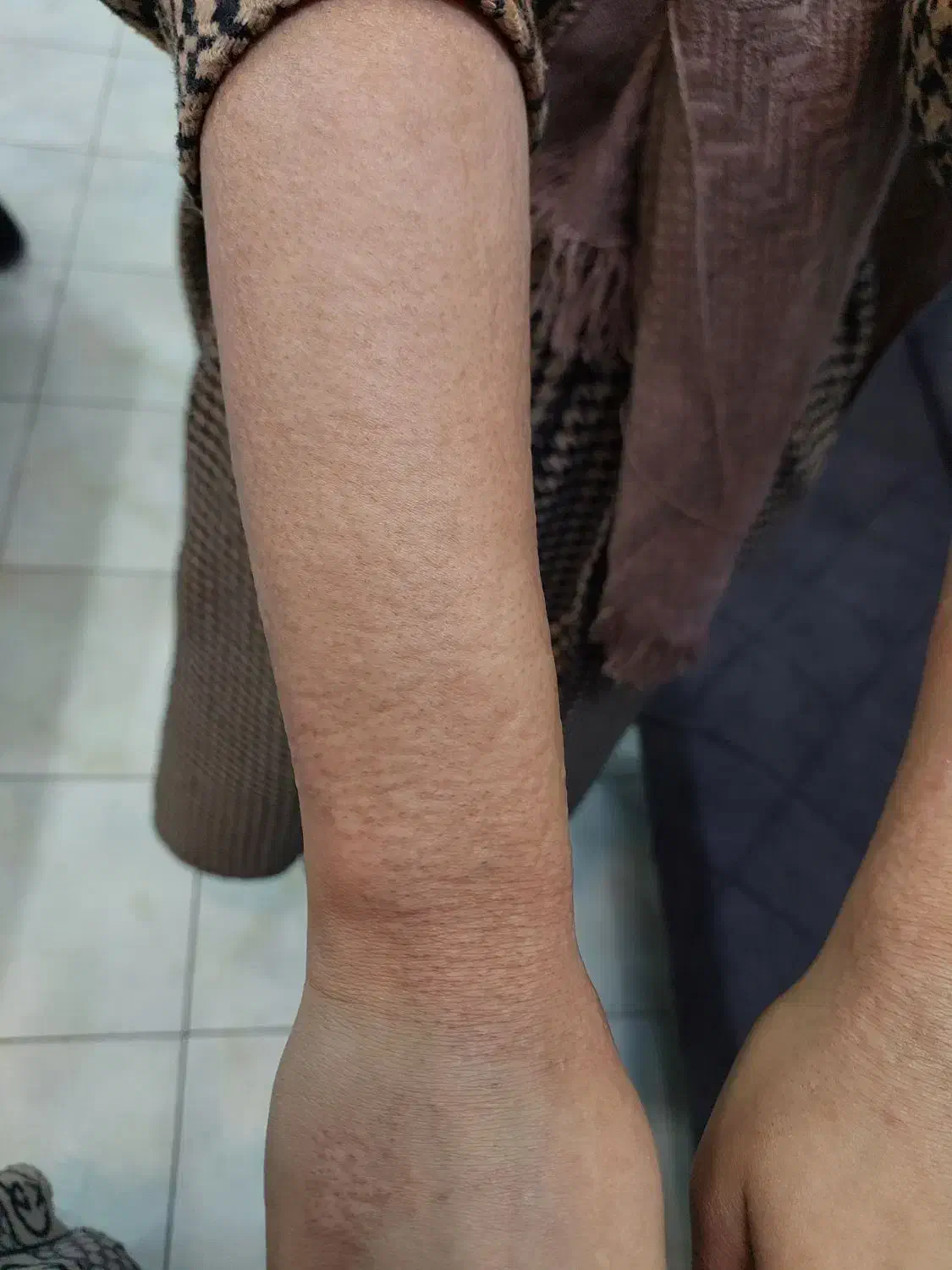 لیزر کندلا با قیمت دوسال پیش|خدمات آرایشگری و زیبایی|اصفهان, بهار آزادی|دیوار