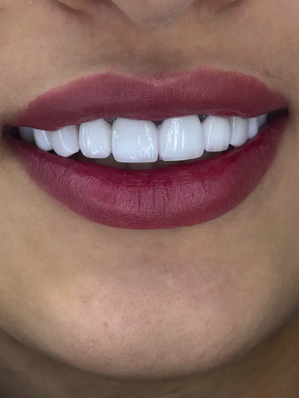 یلدا با تخفیف کامپوزیت|خدمات آرایشگری و زیبایی|ارومیه, |دیوار