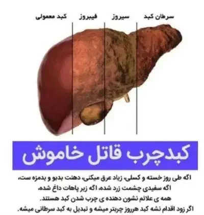 پاکسازی کبد چرب تضمینی|خدمات آرایشگری و زیبایی|گرگان, |دیوار