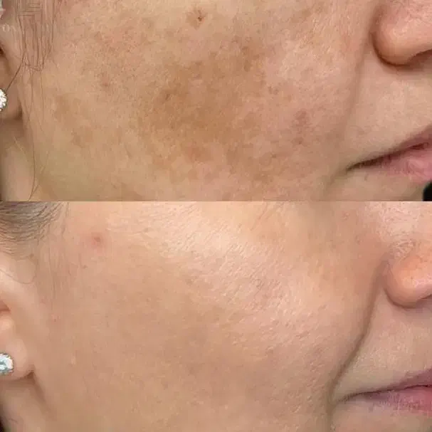 کلینیک تخصصی پوست ومو «پی آر پی،اگزوزوم،مزوتراپی»|خدمات آرایشگری و زیبایی|شیراز, عفیف‌آباد|دیوار