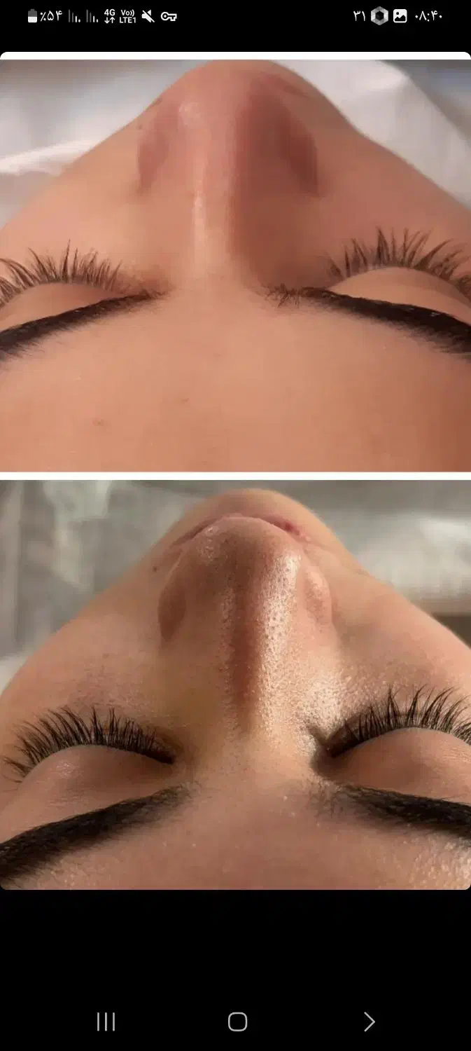 پاکسازی وآبرسانی پوست باتخفیف|خدمات آرایشگری و زیبایی|مرند, |دیوار