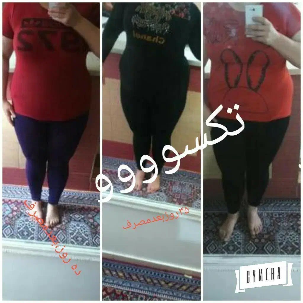 چربی سوز قوی شکم پهلو|خدمات آرایشگری و زیبایی|بهبهان, |دیوار