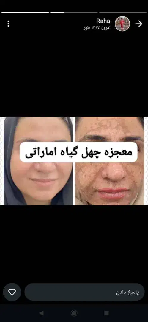 کرم معجزه 43ترکیبه عماراتی|آرایشی، بهداشتی، درمانی|شیراز, سلطان آباد|دیوار