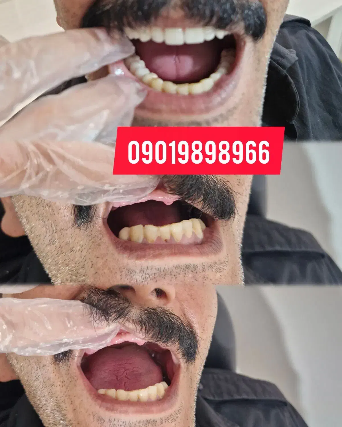 دندانسازی|خدمات آرایشگری و زیبایی|خرم‌آباد, |دیوار