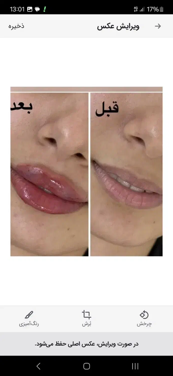 تزریق ژل بوتاکس|خدمات آرایشگری و زیبایی|شیراز, نصرآباد|دیوار