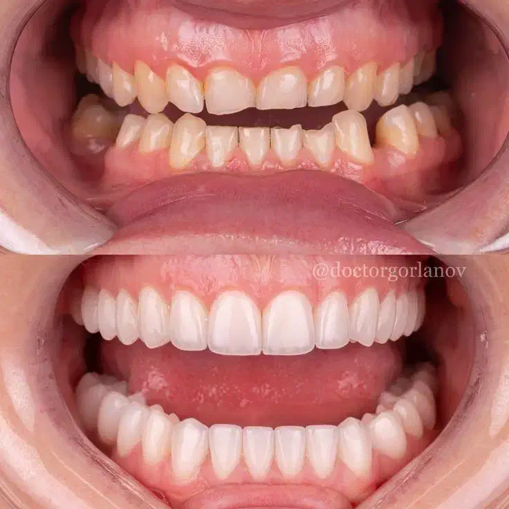 جشنواره ویژه دندان مصنوعی و...فقط 15 تومن|خدمات آرایشگری و زیبایی|فردیس, داوری|دیوار