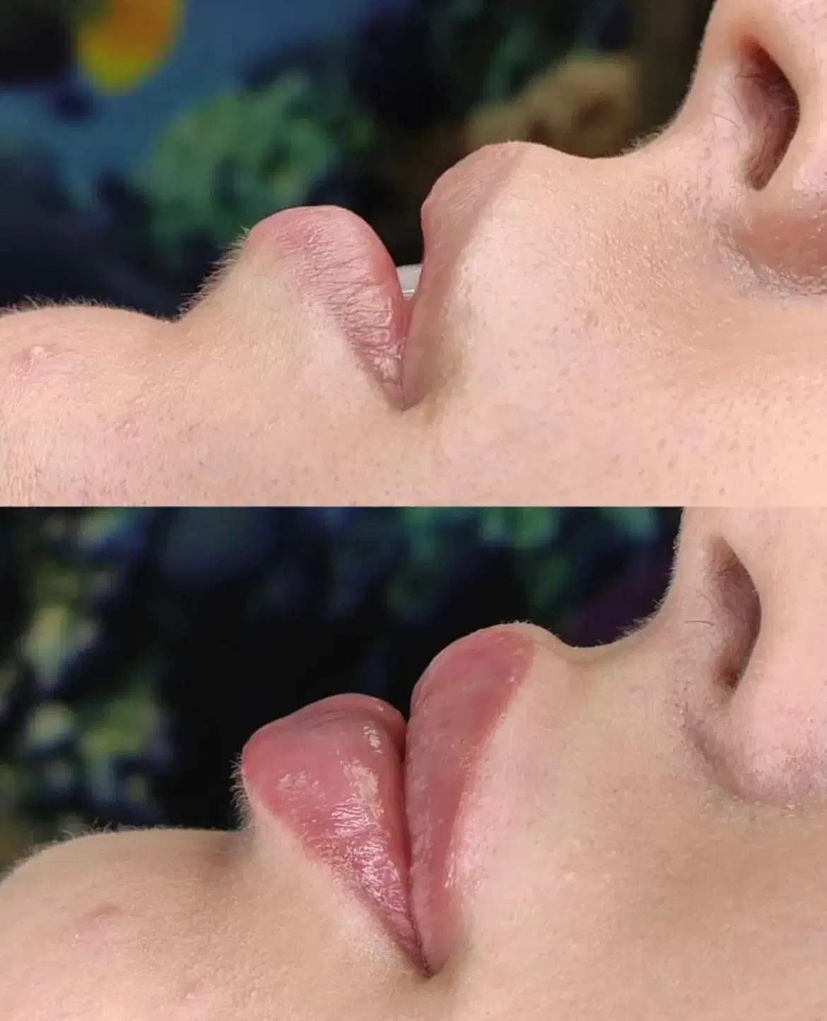 تزریق ژل و بوتاکس|خدمات آرایشگری و زیبایی|بروجرد, |دیوار