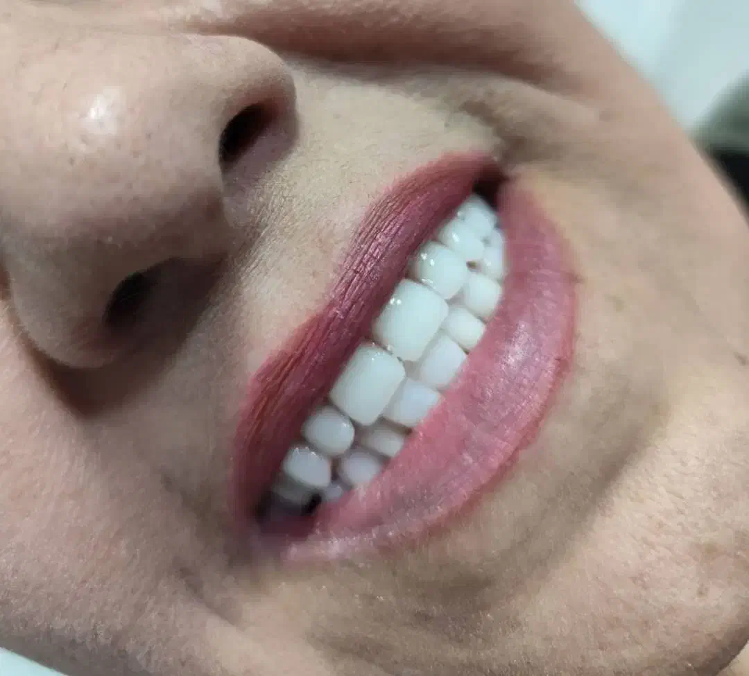 دندان مصنوعی وارداتی هر فک ۵ تومان|خدمات آرایشگری و زیبایی|کرج, کمالشهر|دیوار