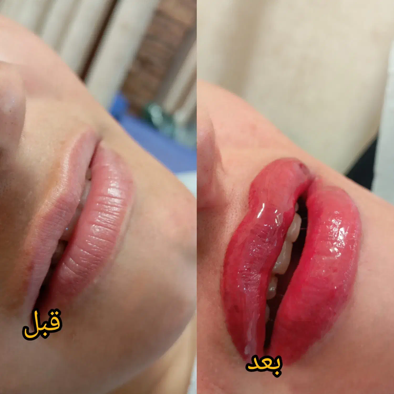 تخفیف بی نظیر شیدینگ لب|خدمات آرایشگری و زیبایی|شیراز, ملاصدرا|دیوار