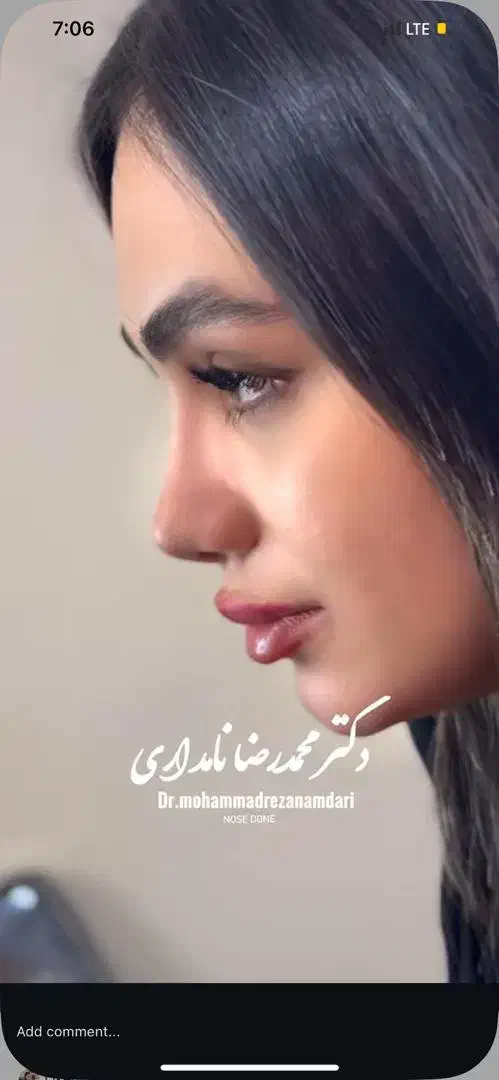 عمل بینی فقط« ۲۹ »میلیون روز ۸  و ۹ اذر|خدمات آرایشگری و زیبایی|تهران, پاسداران|دیوار