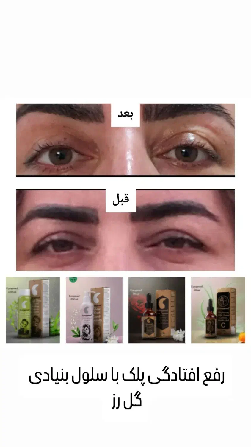 سرم جوانساز گل رز آریا|آرایشی، بهداشتی، درمانی|شیراز, عفیف‌آباد|دیوار