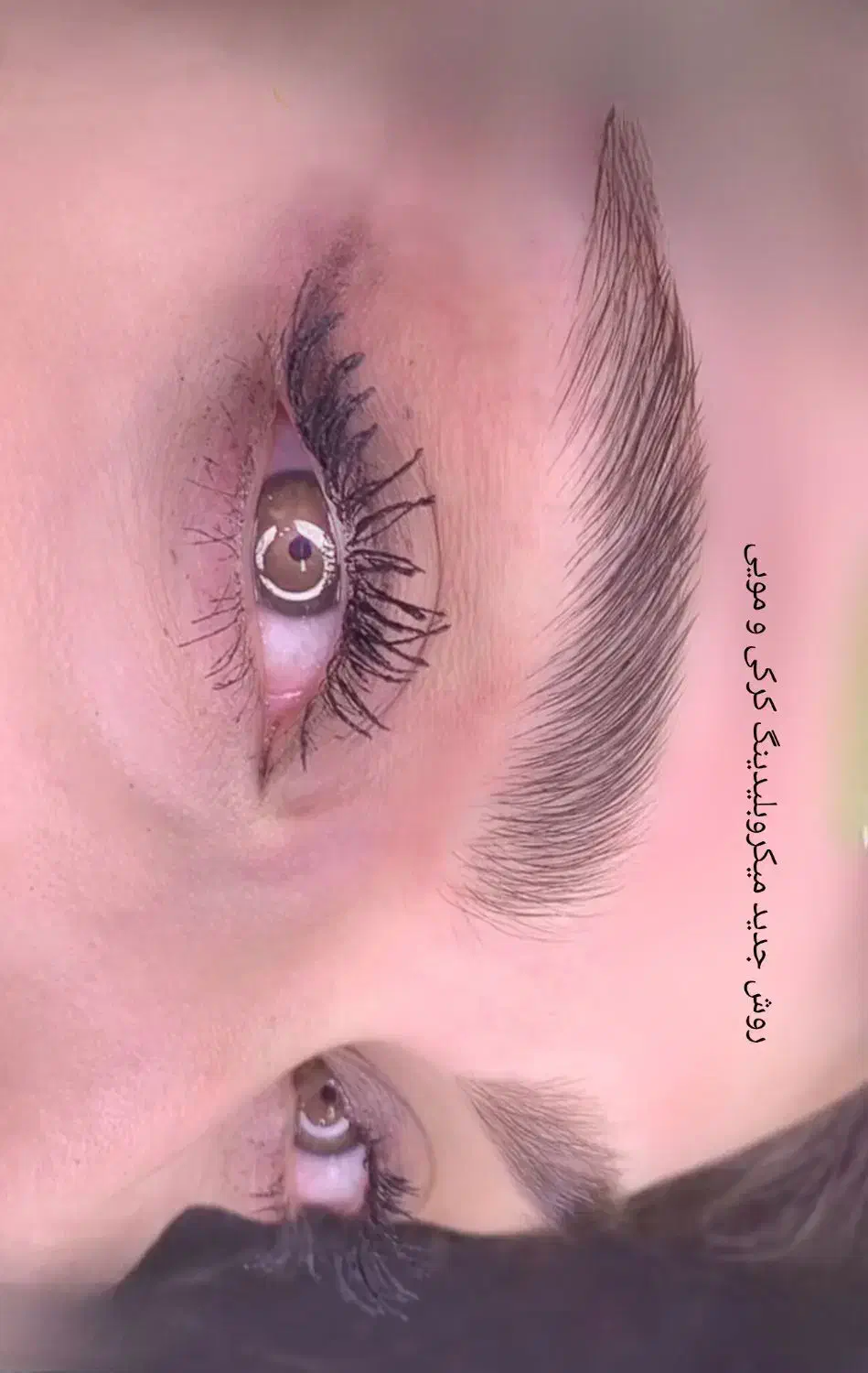 میکرو آفر ویژه روش کرکی مویی ریمو تک جلسه|خدمات آرایشگری و زیبایی|مشهد, آزادشهر|دیوار