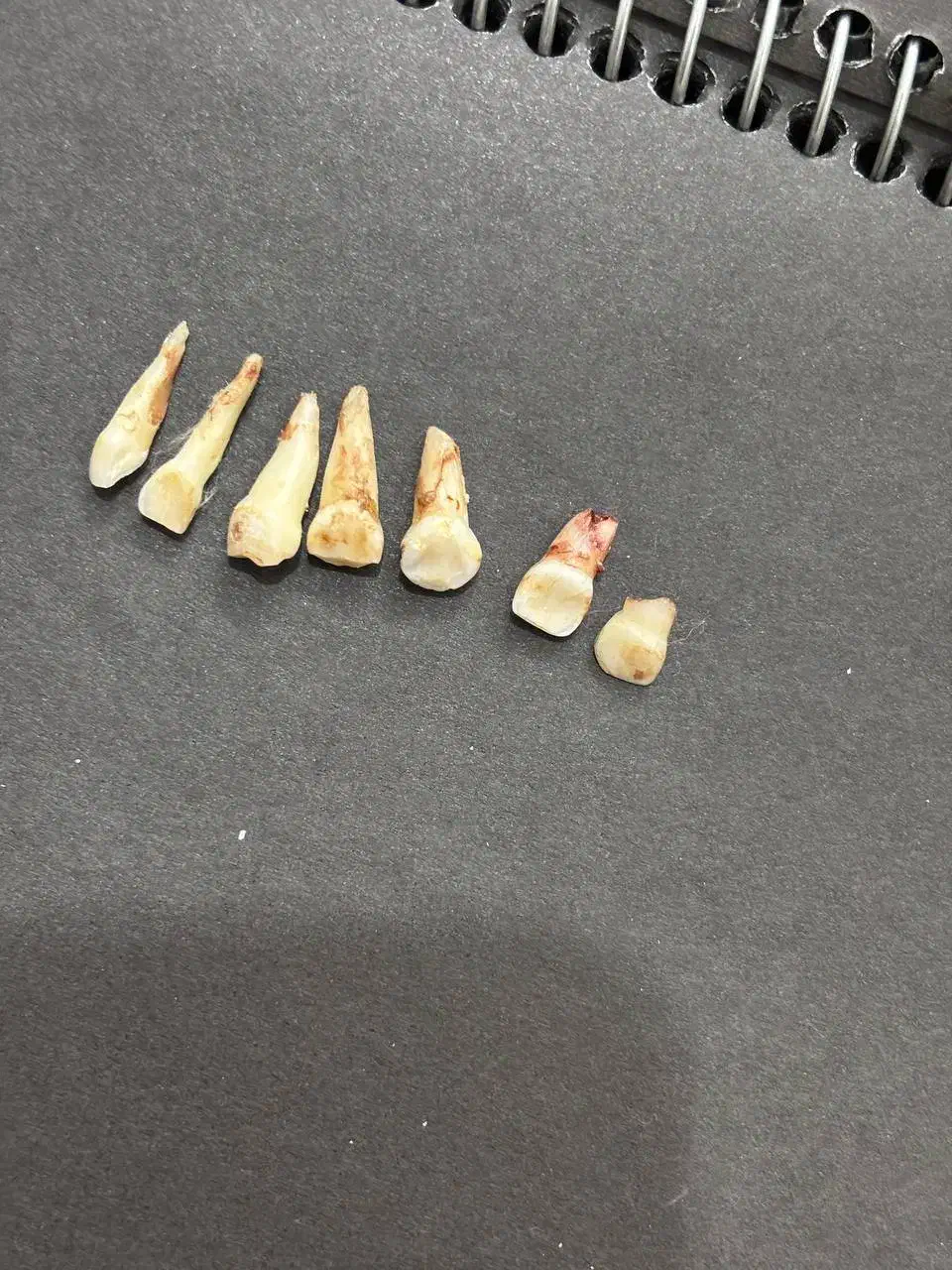 دندان شیری و دائمی برای دانشجویان|پزشکی|بیرجند, |دیوار