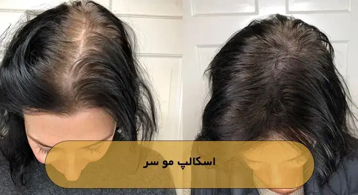 انجام خدمات تتو صورت و بدن بانوان ،اسکالپ کف سر|خدمات آرایشگری و زیبایی|فولادشهر, A2|دیوار