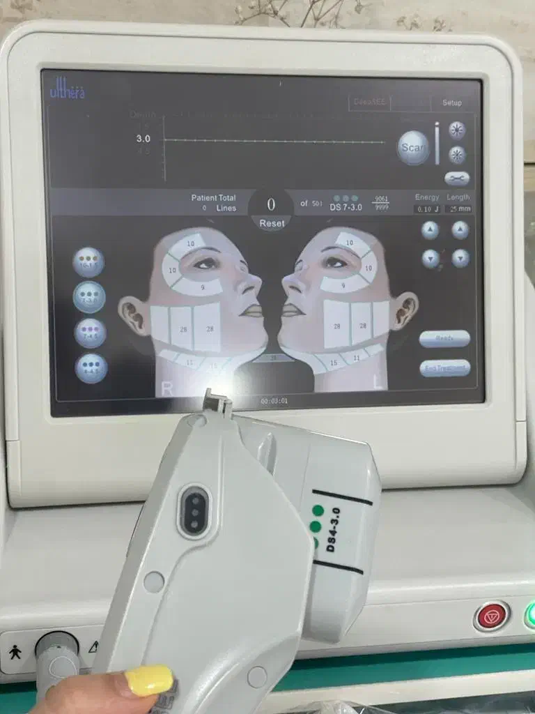 هایفو اولترا کره ای ۵بعدی|آرایشی، بهداشتی، درمانی|بم, |دیوار