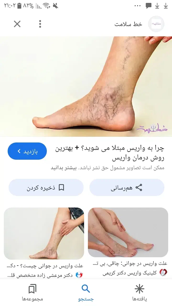 واریس|فعالیت داوطلبانه|گالیکش, |دیوار