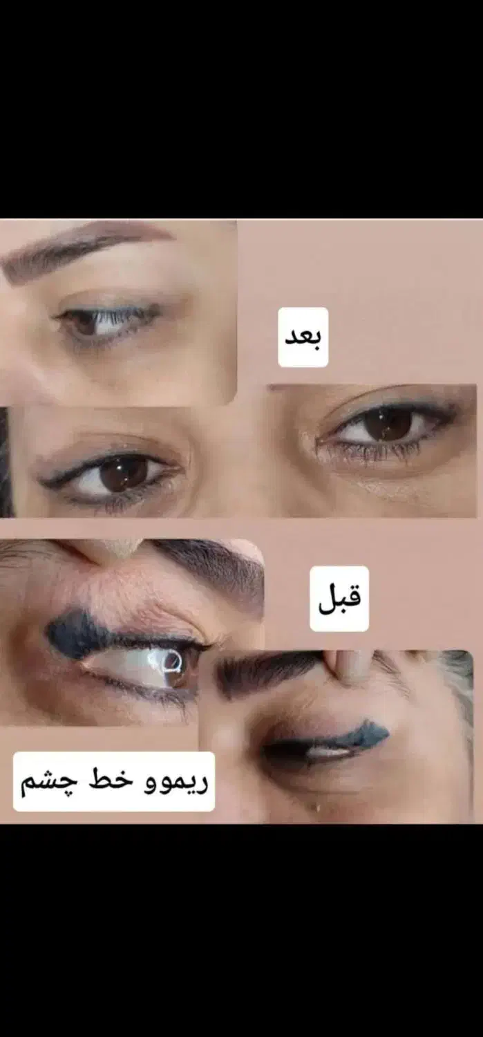 ریموو(پاک کردن)تتو ابرو چشم لب|خدمات آرایشگری و زیبایی|دوگنبدان, |دیوار