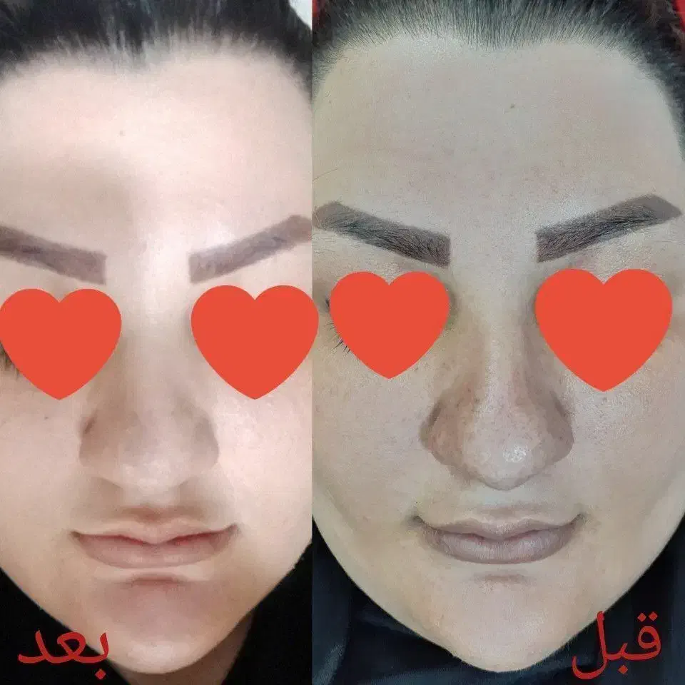 محصولات آرایشی و بهداشتی|آرایشی، بهداشتی، درمانی|تهران, بهار|دیوار