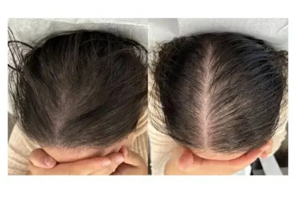 خدمات prpو prf|خدمات زیبایی و سلامت|کرمانشاه, |دیوار