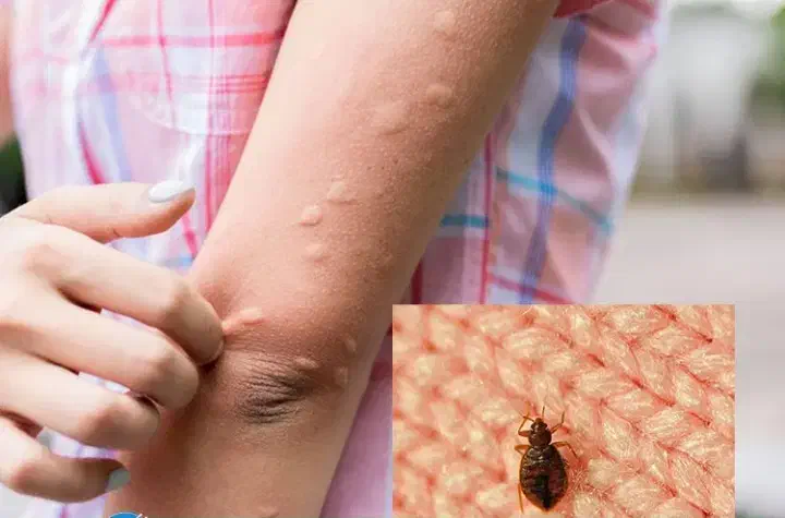 سم پاشی سوسک وموریانه زدایی|خدمات نظافت|هندیجان, |دیوار