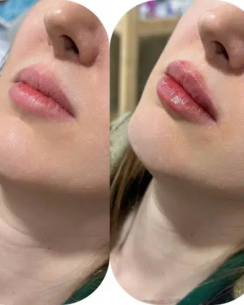 جشنواره ژل لب بوتاکس 700|خدمات آرایشگری و زیبایی|شیراز, زرهی|دیوار