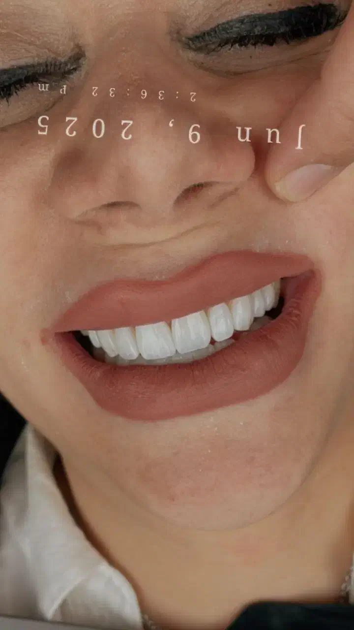 جشنواره بمناسبت روز مادر ایمپلنت، عصب کشی، جراحی،|خدمات آرایشگری و زیبایی|مشهد, شریف|دیوار