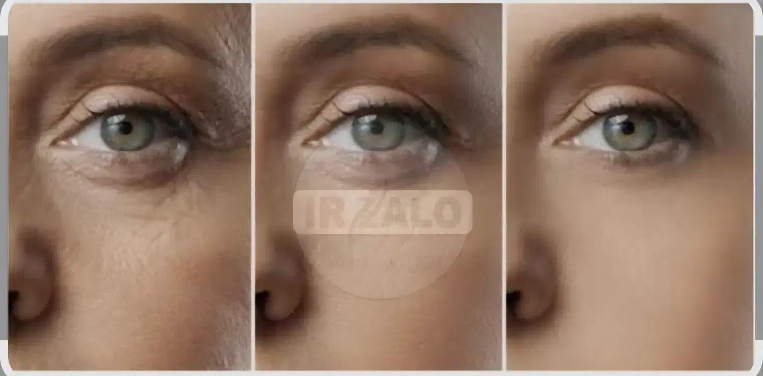 روغن درمانی|آرایشی، بهداشتی، درمانی|پاکدشت, پاکدشت (مامازند)|دیوار