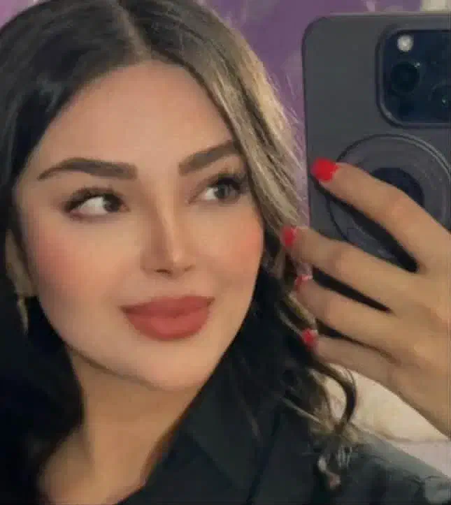 30درصد تخفیف عمل بینی و پیکرتراشی فوق تخصص پلاستیک|خدمات آرایشگری و زیبایی|تهران, محمودیه|دیوار