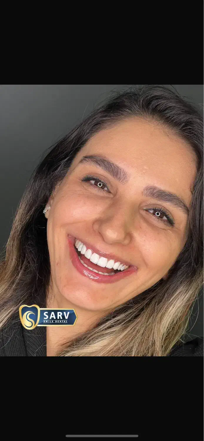 بزرگترین جشنواره تخفیفی کلینیک دندانپزشکی سرو|خدمات آرایشگری و زیبایی|تهران, قیطریه|دیوار