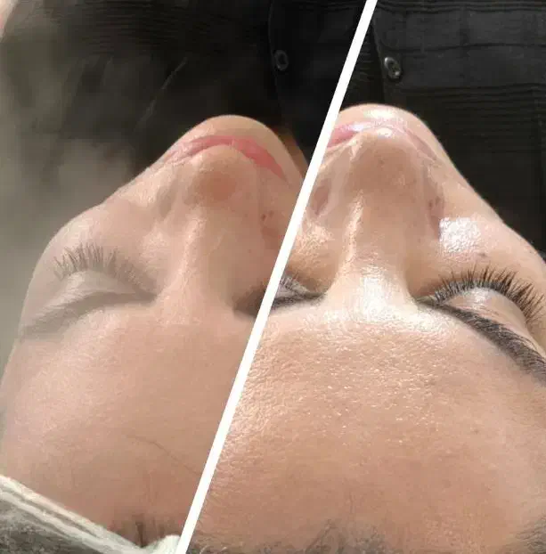 فشیال وپاکسازی|خدمات آرایشگری و زیبایی|شیراز, شهرک فرهنگیان|دیوار