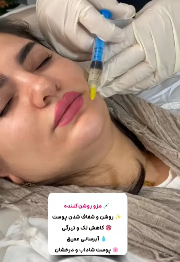 تزریق ژل و بوتاکس و مزو و پی آرپی|خدمات زیبایی و سلامت|تهران, نعمتآباد|دیوار