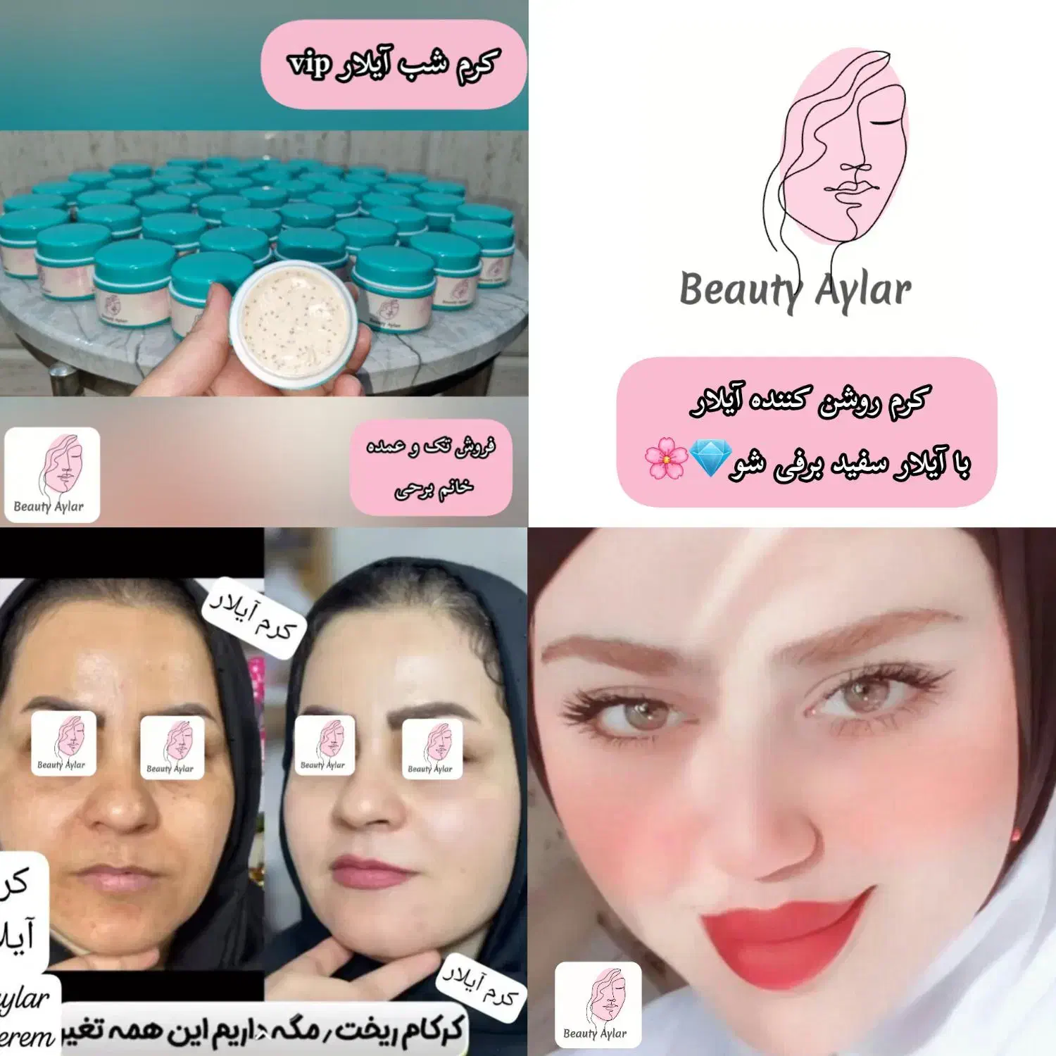 پوستت کدر و تیره شده نگران نباش با آیلار میدرخشی|آرایشی، بهداشتی، درمانی|میبد, |دیوار