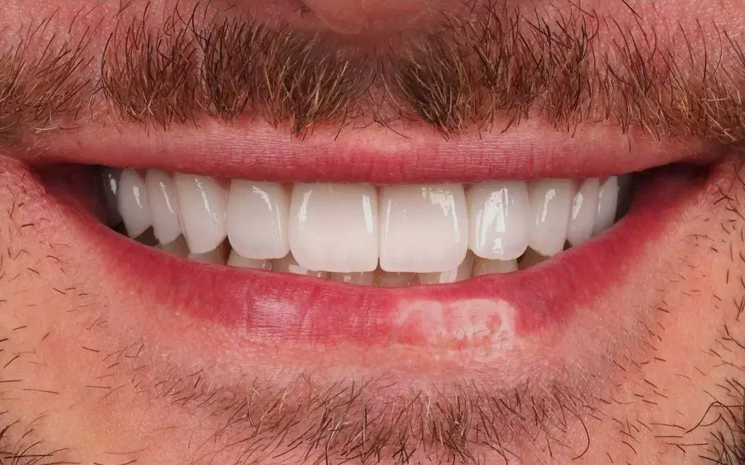 خدمات دندانپزشکی و زیبایی دندان|خدمات آرایشگری و زیبایی|اسلام‌شهر, شهرک مهدیه|دیوار