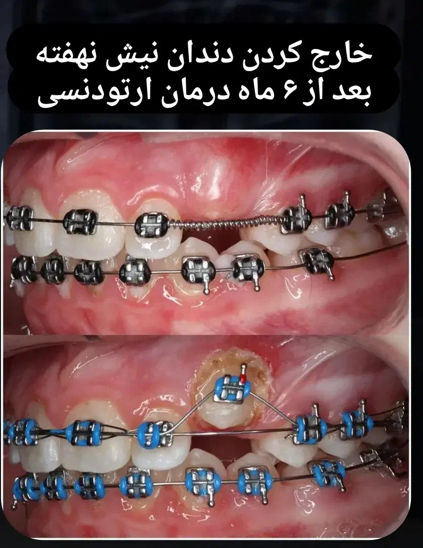 ارتودنسی ارزانتر از تعرفه نظام پزشکی،ایمپلنت فوری|خدمات آرایشگری و زیبایی|تهران, آذربایجان|دیوار