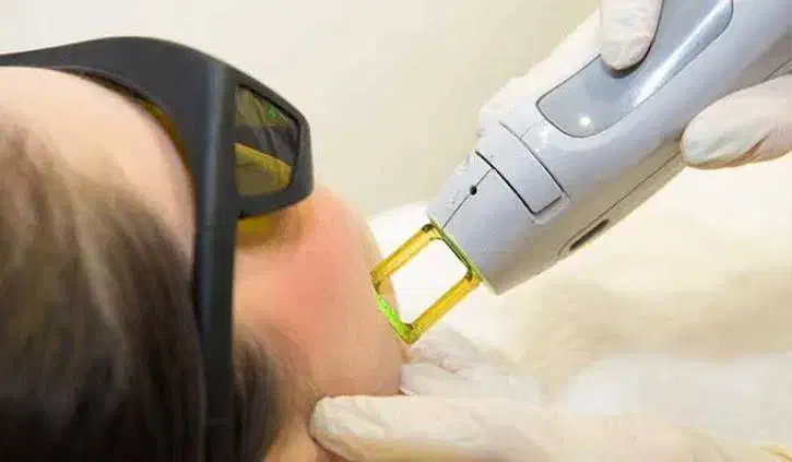 آگهی استخدام اپراتور لیزر موهای زائد (خانم)|استخدام درمانی، زیبایی، بهداشتی|ابهر, |دیوار