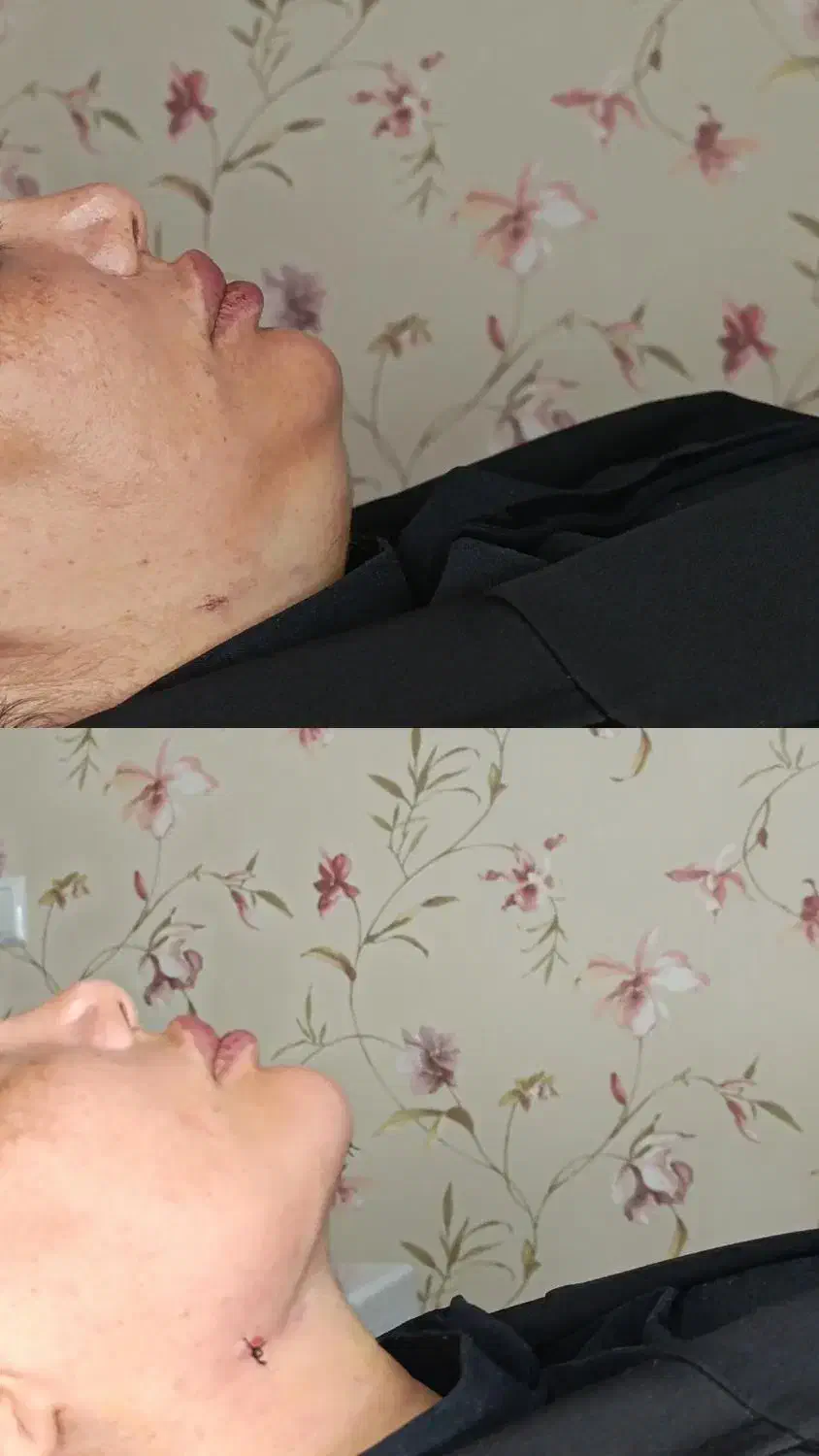 کیلینک زیبایی پاستور تخصصی ترین کیلینک زنجان|خدمات آرایشگری و زیبایی|زنجان, |دیوار