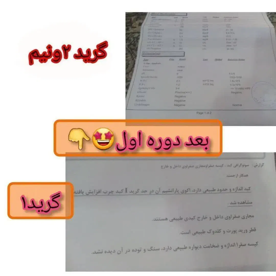 درمان تضمینی کبدجرب بامحصولات گیاهی شرکت کاژان|خوردنی و آشامیدنی|رباط‌کریم, شهرک صنعتی نصیرآباد|دیوار