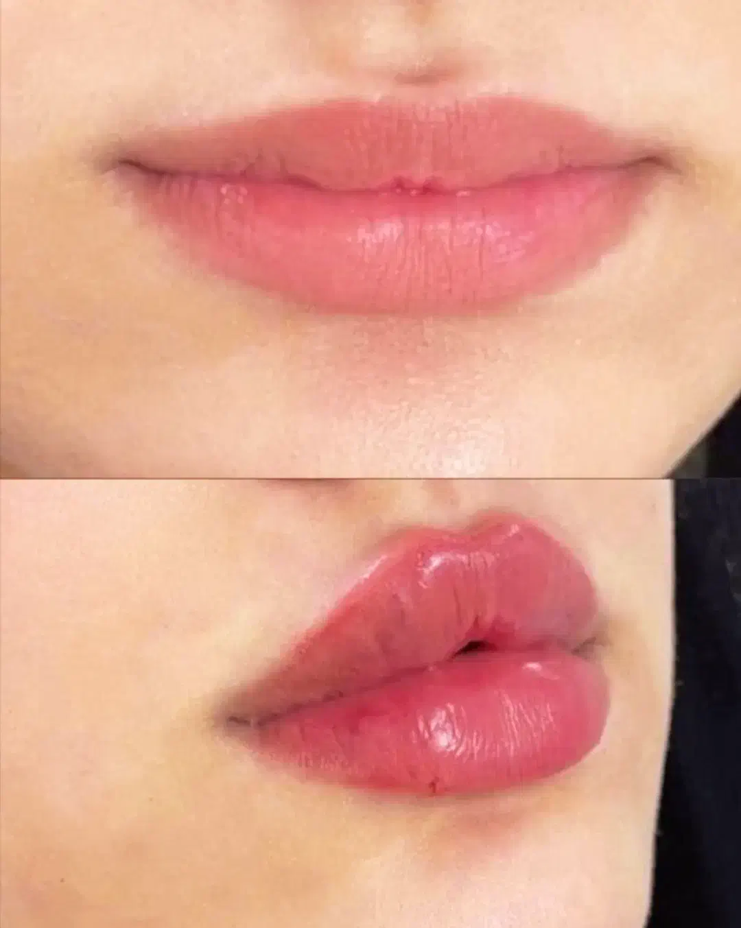 تزریق ژل و بوتاکس، نخ، مزو، فیلربادی|خدمات آرایشگری و زیبایی|ری, اقدسیه|دیوار