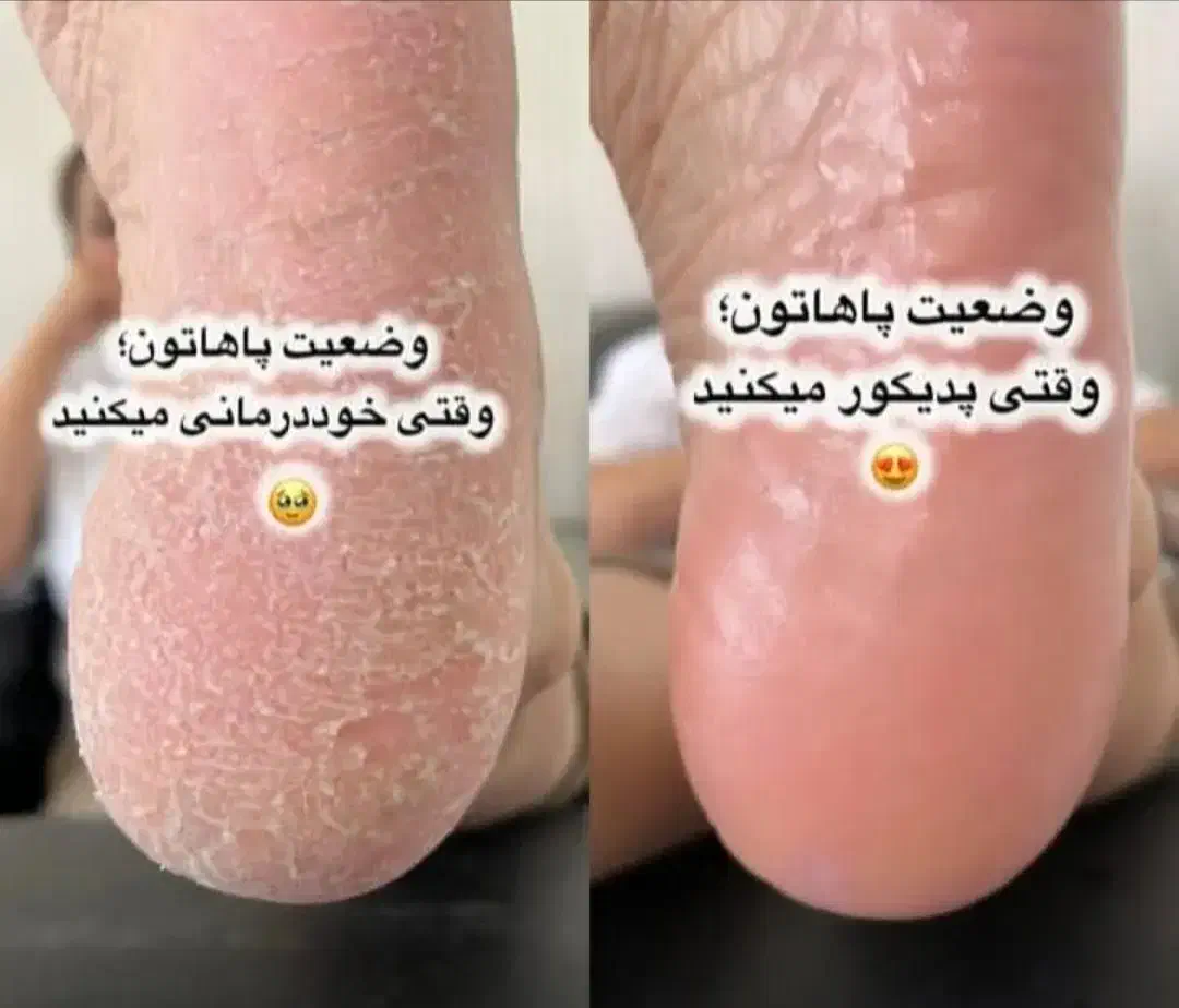 پدیکور و کفسابی پارافین تراپی|خدمات آرایشگری و زیبایی|گلبهار, شهر جدید گلبهار|دیوار