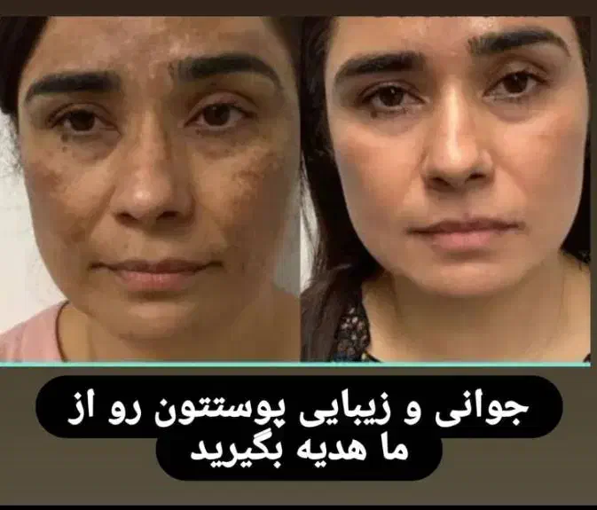 کرم معجزه چهل گیاه اصلی با ضمانت|آرایشی، بهداشتی، درمانی|شیراز, کوشک میدان|دیوار