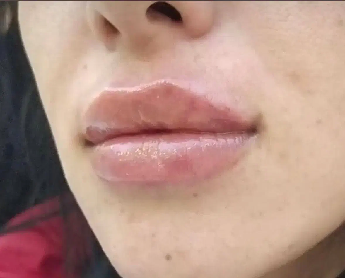 نیازمند مدل جهت تزریق فیلر|خدمات آرایشگری و زیبایی|زاهدان, |دیوار