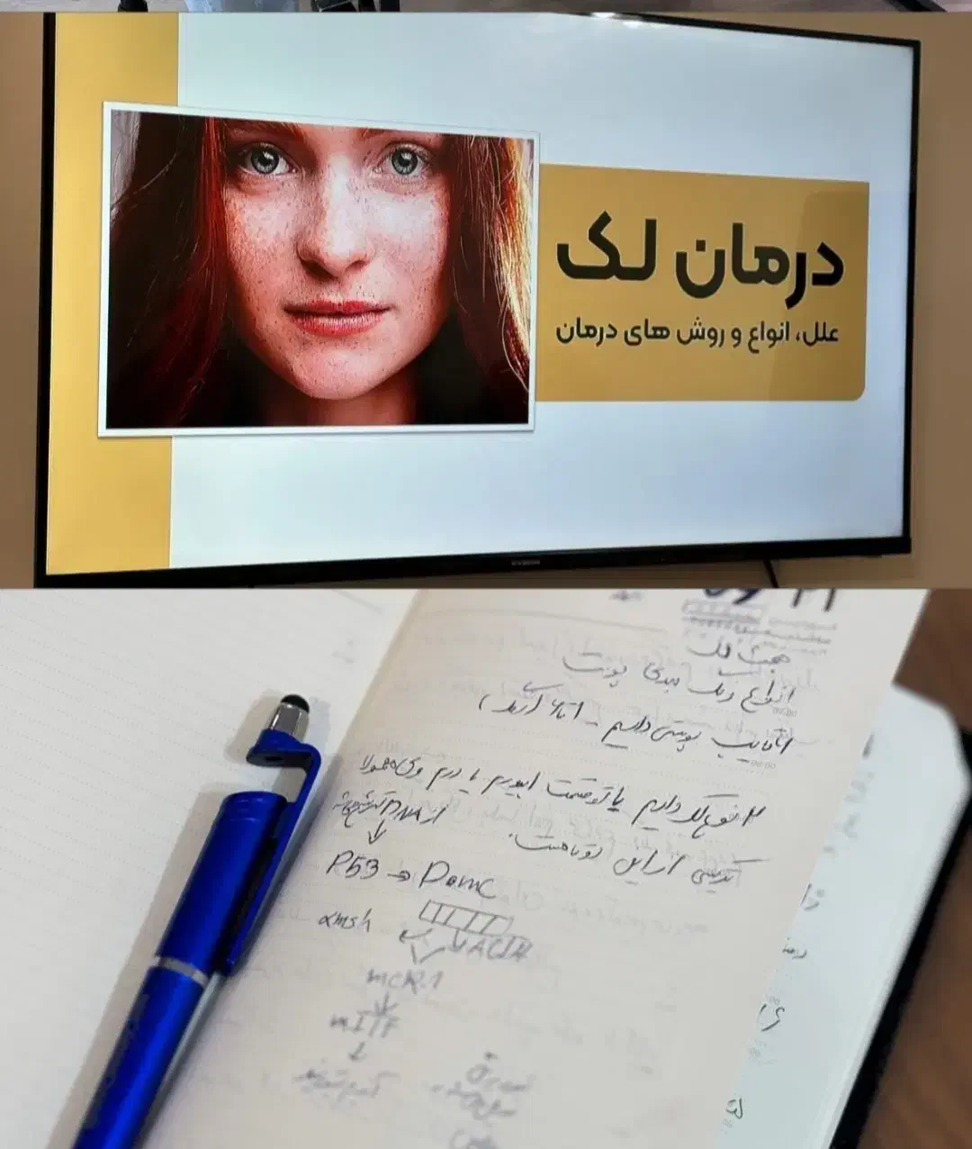 آموزش صفر تا صد فیشال پوست ،اسکراب و اسکالپ سر|خدمات آموزشی|قزوین, |دیوار