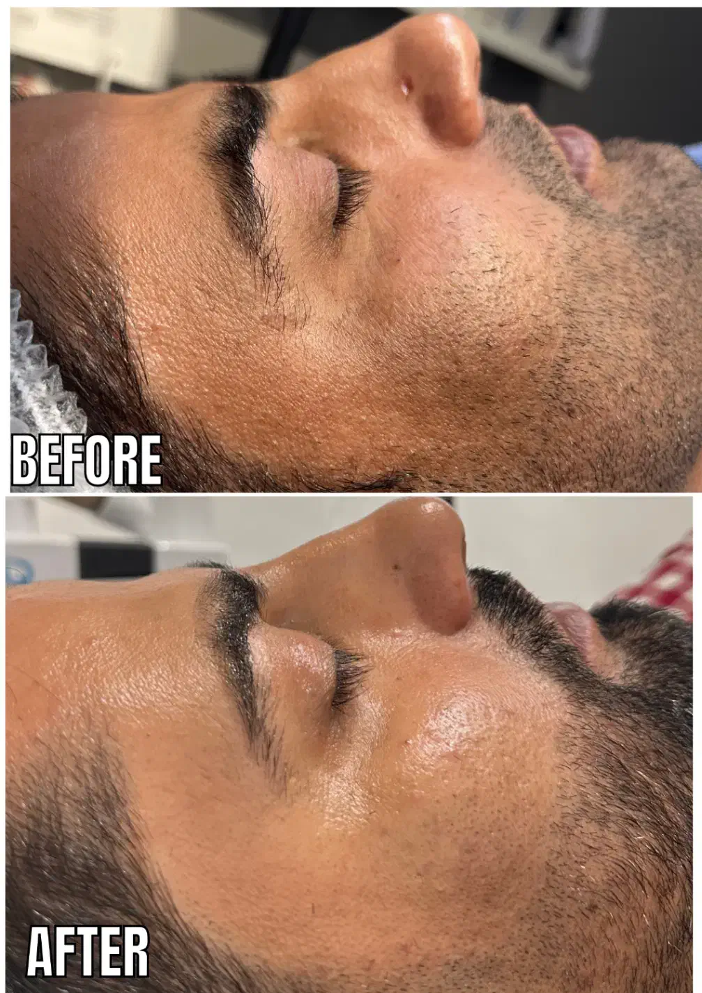 مدل پاکسازی صورت و بدن(خانم و اقا)باهم یا جدا|خدمات آرایشگری و زیبایی|مشهد, کوثر|دیوار