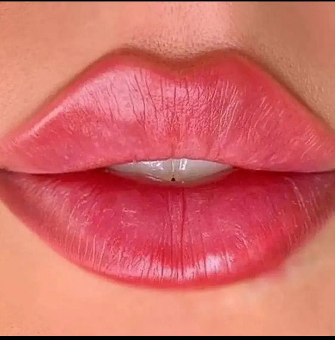خدمات ژل / بوتاکس / جوانسازی/رفع چین و چروک صورت|خدمات آرایشگری و زیبایی|شاهین‌شهر, فردوسی|دیوار