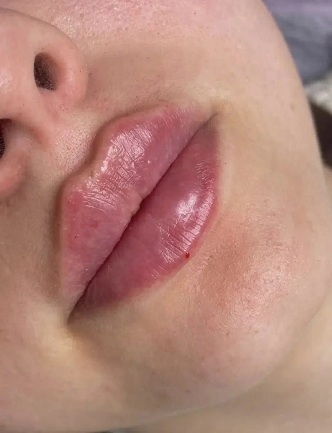 کلینیک زیبایی بانوان|خدمات آرایشگری و زیبایی|کرمان, |دیوار